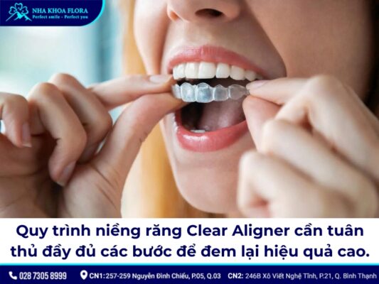 Niềng răng trong suốt Clear Aligner - ảnh 4 Niềng răng trong suốt Clear Aligner - ảnh 4