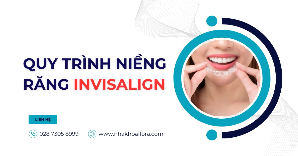 Quy trình niềng răng Invisalign chuẩn Y khoa như thế nào?
