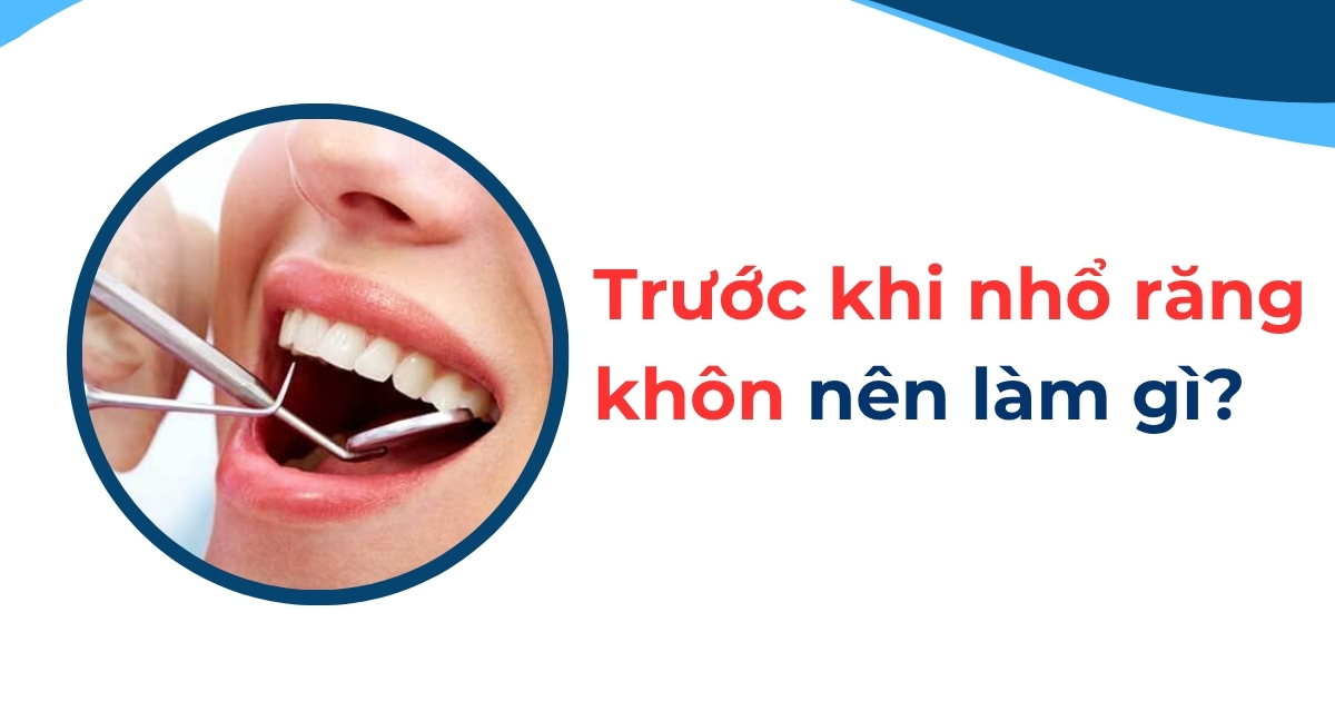 Trước khi nhổ răng khôn nên làm gì để an toàn, hiệu quả?