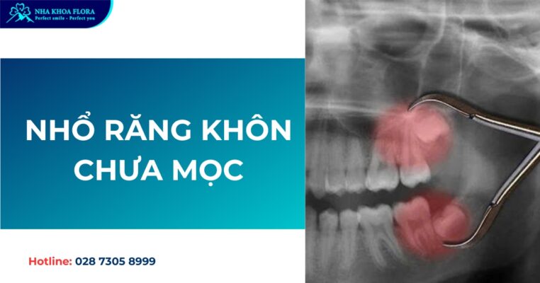 nhổ răng khôn chưa mọc