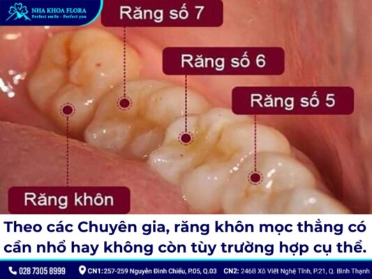 nhổ răng khôn mọc thẳng - ảnh 1 nhổ răng khôn mọc thẳng - ảnh 1