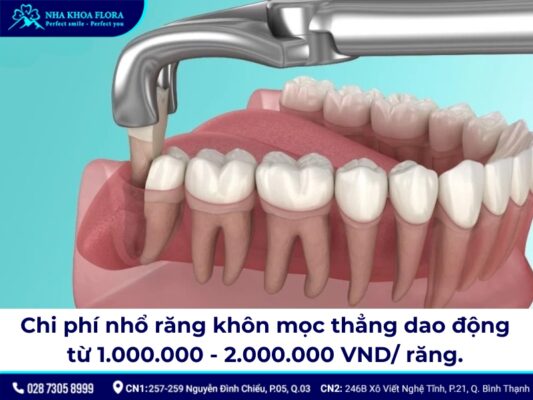 nhổ răng khôn mọc thẳng - ảnh 4 nhổ răng khôn mọc thẳng - ảnh 4