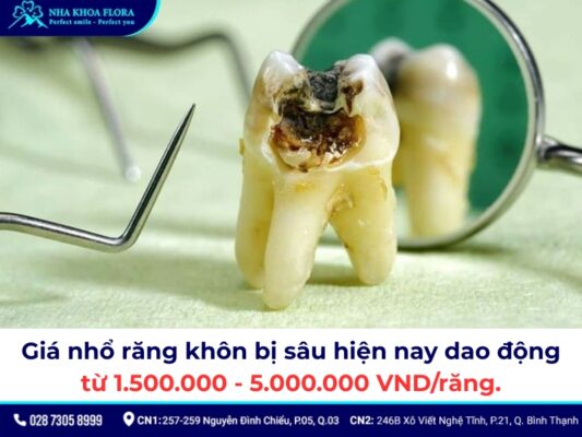 giá nhổ răng khôn bị sâu - ảnh 1 giá nhổ răng khôn bị sâu - ảnh 1