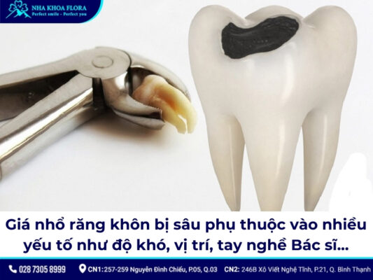 giá nhổ răng khôn bị sâu - ảnh 2 giá nhổ răng khôn bị sâu - ảnh 2