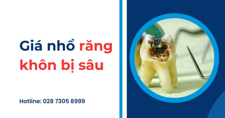 giá nhổ răng khôn bị sâu