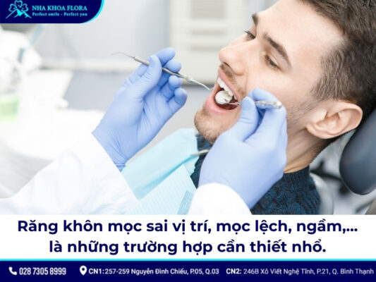 nên nhổ răng khôn ở bệnh viện hay phòng khám - ảnh 1 nên nhổ răng khôn ở bệnh viện hay phòng khám - ảnh 1
