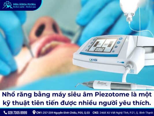nhổ răng khôn bằng máy siêu âm - ảnh 1 nhổ răng khôn bằng máy siêu âm - ảnh 1