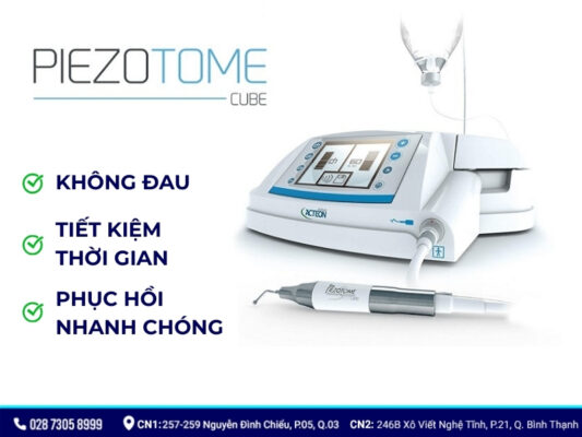 nhổ răng khôn bằng máy siêu âm - ảnh 2 nhổ răng khôn bằng máy siêu âm - ảnh 2
