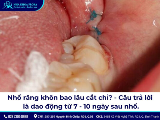 nhổ răng khôn bao lâu cắt chỉ - ảnh 1