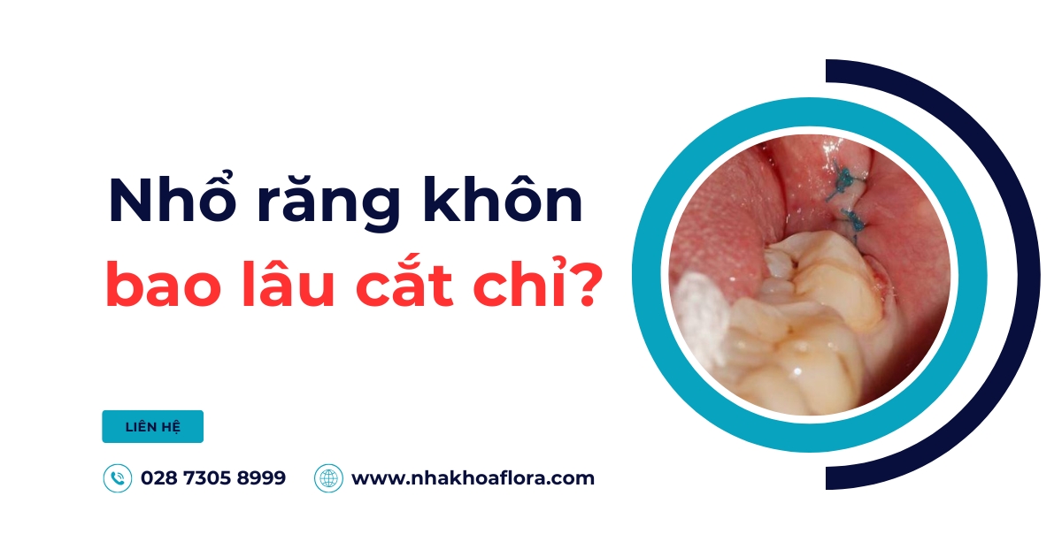 Nhổ răng khôn bao lâu cắt chỉ? Có đau không? Cần lưu ý gì?