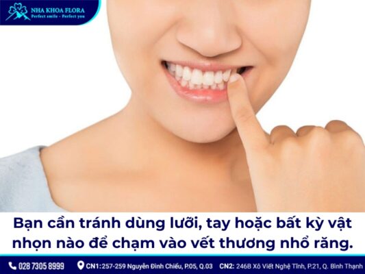nhổ răng khôn chảy máu bao lâu - ảnh 2