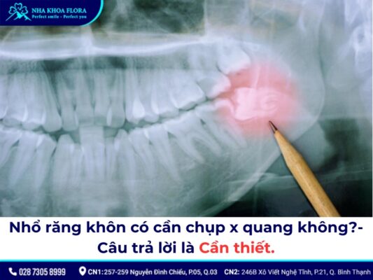 nhổ răng khôn có cần chụp x quang không - ảnh 1 nhổ răng khôn có cần chụp x quang không - ảnh 1