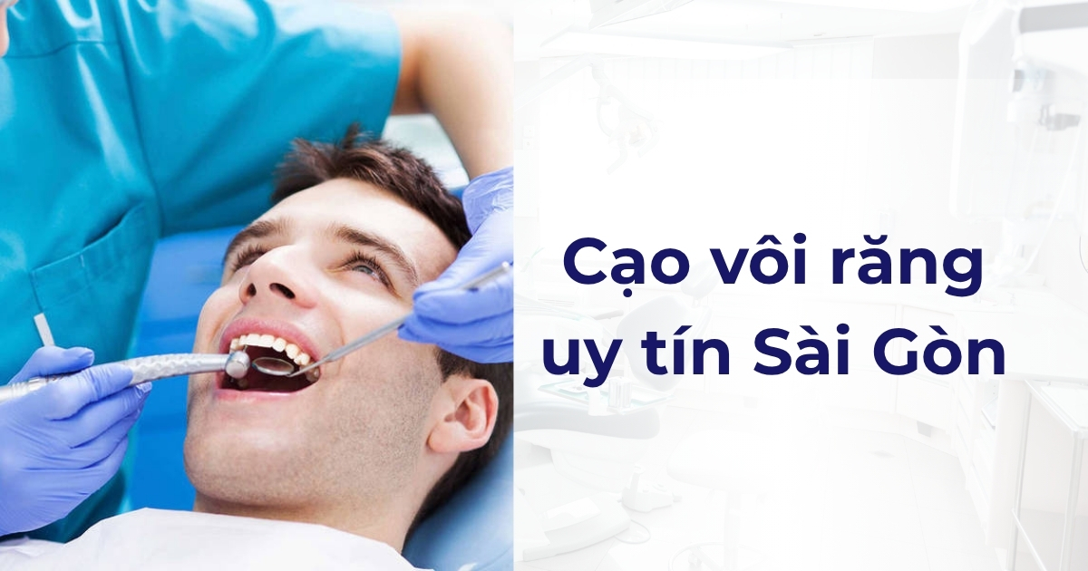 Cạo vôi răng uy tín Sài Gòn: Bật mí 6 địa chỉ uy tín nhất