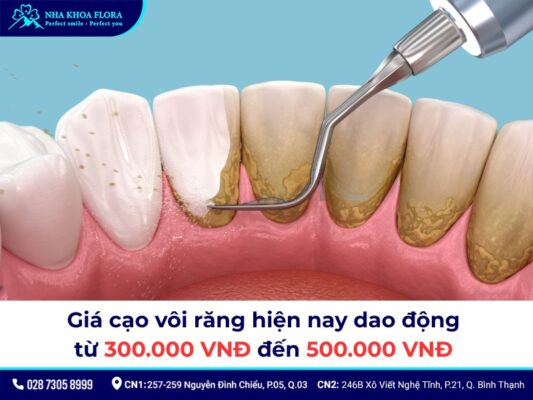 giá cạo vôi răng - ảnh 1
