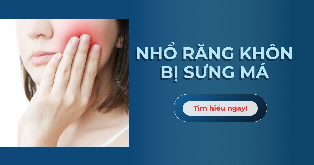 Nhổ răng khôn bị sưng má: Nguyên nhân và cách khắc phục