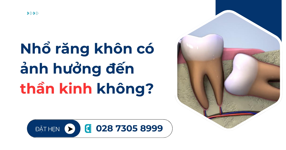 [Hỏi đáp]: Nhổ răng khôn có ảnh hưởng đến thần kinh không?