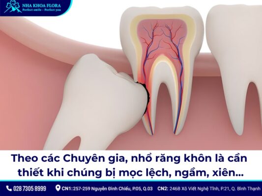 Nhổ răng khôn có bị hóp má không? - ảnh 1