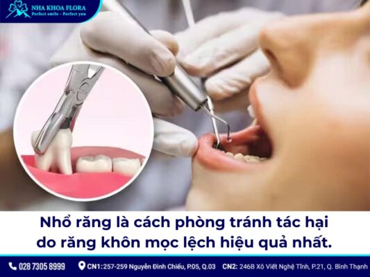 nhổ răng khôn hàm dưới mọc lệch - ảnh 4