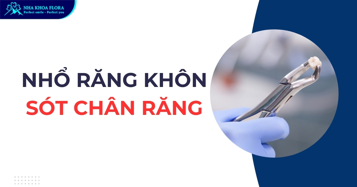 Nhổ răng khôn sót chân răng do đâu? Có ảnh hưởng gì không?