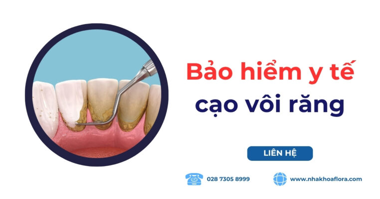 Bảo hiểm y tế cạo vôi răng có được áp dụng? Giảm bao nhiêu? 8