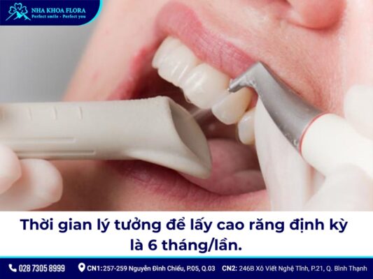 bao lâu cạo vôi răng - ảnh 1