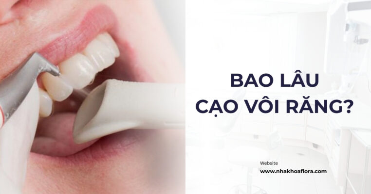 Bao lâu cạo vôi răng 1 lần để tránh các bệnh lý răng miệng? 9