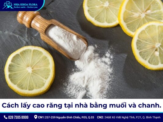cách cạo vôi răng - ảnh 1 cách cạo vôi răng - ảnh 1