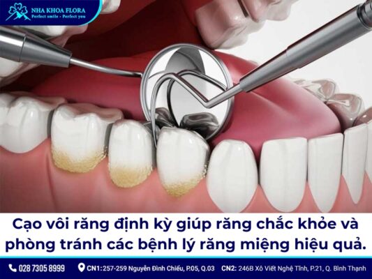 cạo vôi răng chảy máu - ảnh 1 cạo vôi răng chảy máu - ảnh 1