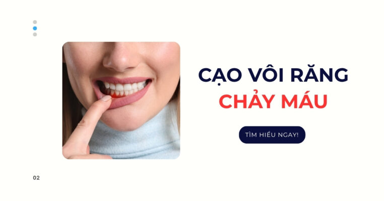 Cạo vôi răng chảy máu: Nguyên nhân do đâu và Cách khắc phục 4