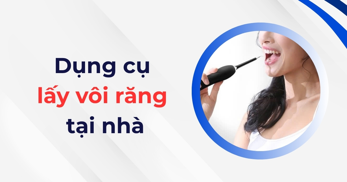 Dụng cụ lấy vôi răng tại nhà là gì? Có nên thực hiện không? 6