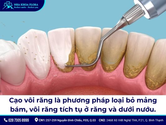 giá cạo vôi răng và tẩy trắng răng - ảnh 1 giá cạo vôi răng và tẩy trắng răng - ảnh 1