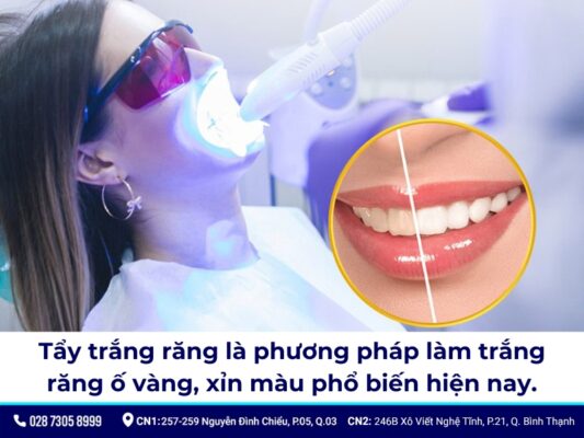 giá cạo vôi răng và tẩy trắng răng - ảnh 2 giá cạo vôi răng và tẩy trắng răng - ảnh 2