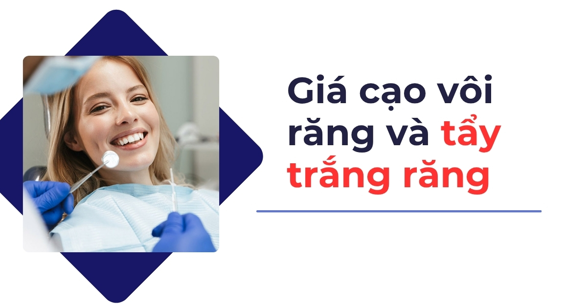 Bảng giá cạo vôi răng và tẩy trắng răng mới nhất hiện nay