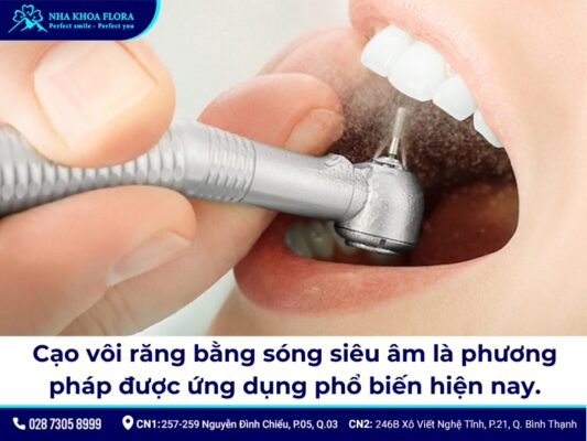 lấy cao răng bằng máy siêu âm giá bao nhiêu - ảnh 1 lấy cao răng bằng máy siêu âm giá bao nhiêu - ảnh 1