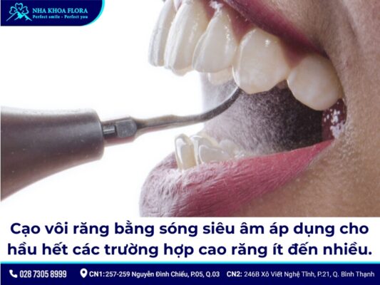 lấy cao răng bằng máy siêu âm giá bao nhiêu - ảnh 3 lấy cao răng bằng máy siêu âm giá bao nhiêu - ảnh 3