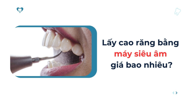 Lấy cao răng bằng máy siêu âm giá bao nhiêu tiền hiện nay? 5