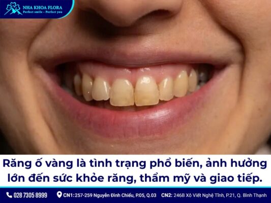 Răng ố vàng có tẩy trắng được không? - ảnh 1 Răng ố vàng có tẩy trắng được không? - ảnh 1