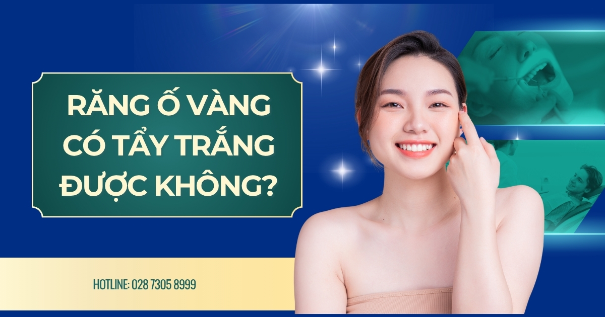 [Hỏi đáp]: Răng ố vàng có tẩy trắng được không thưa Bác sĩ? 6