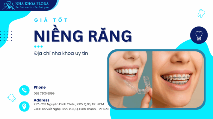 niềng răng