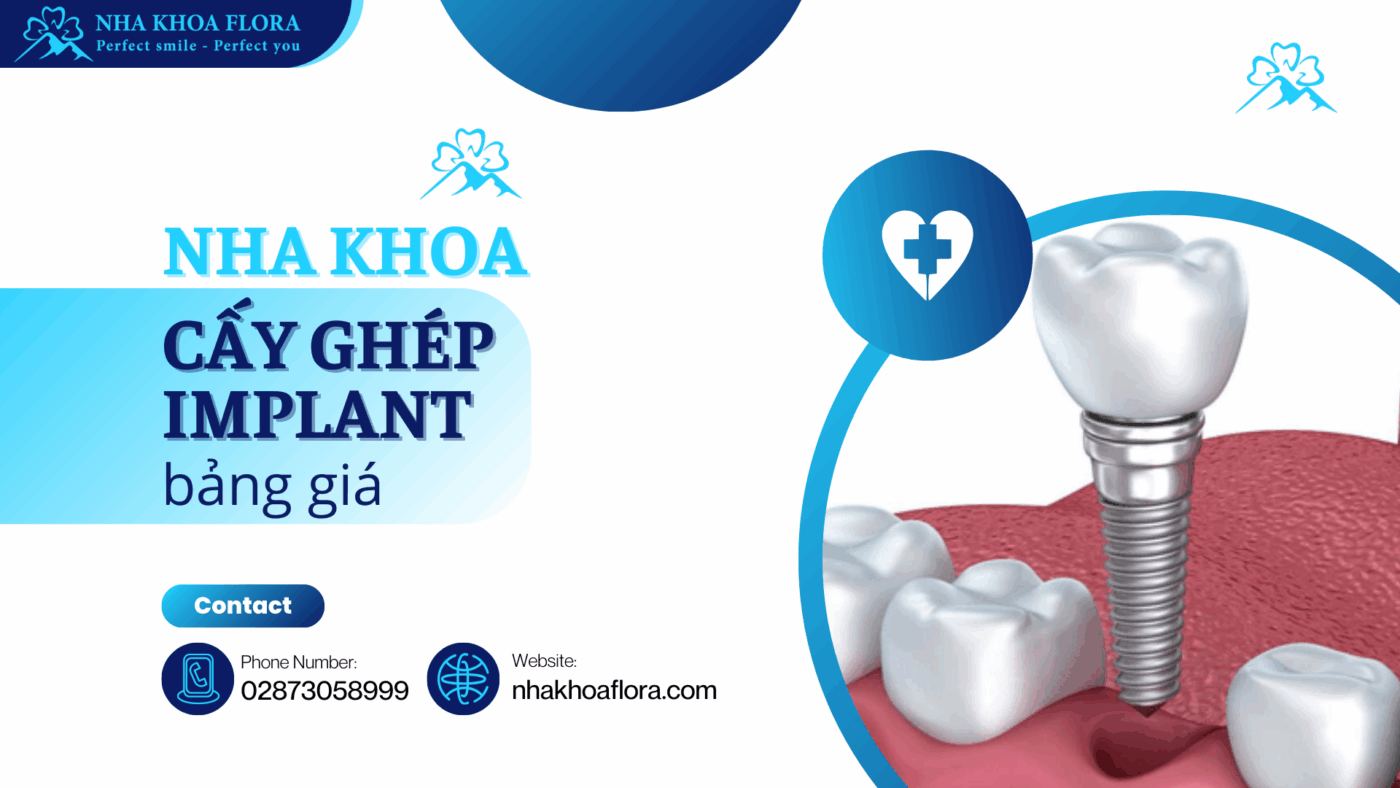 nha khoa cấy ghép Implant