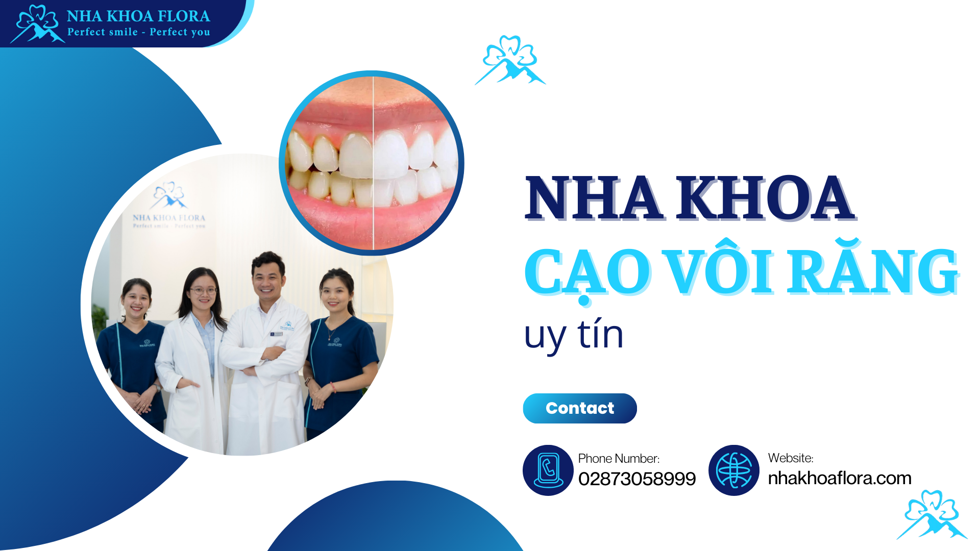 Nha khoa cạo vôi răng