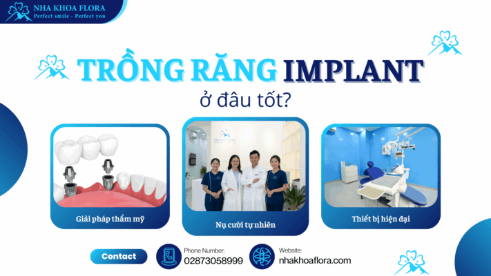 Trồng răng Implant