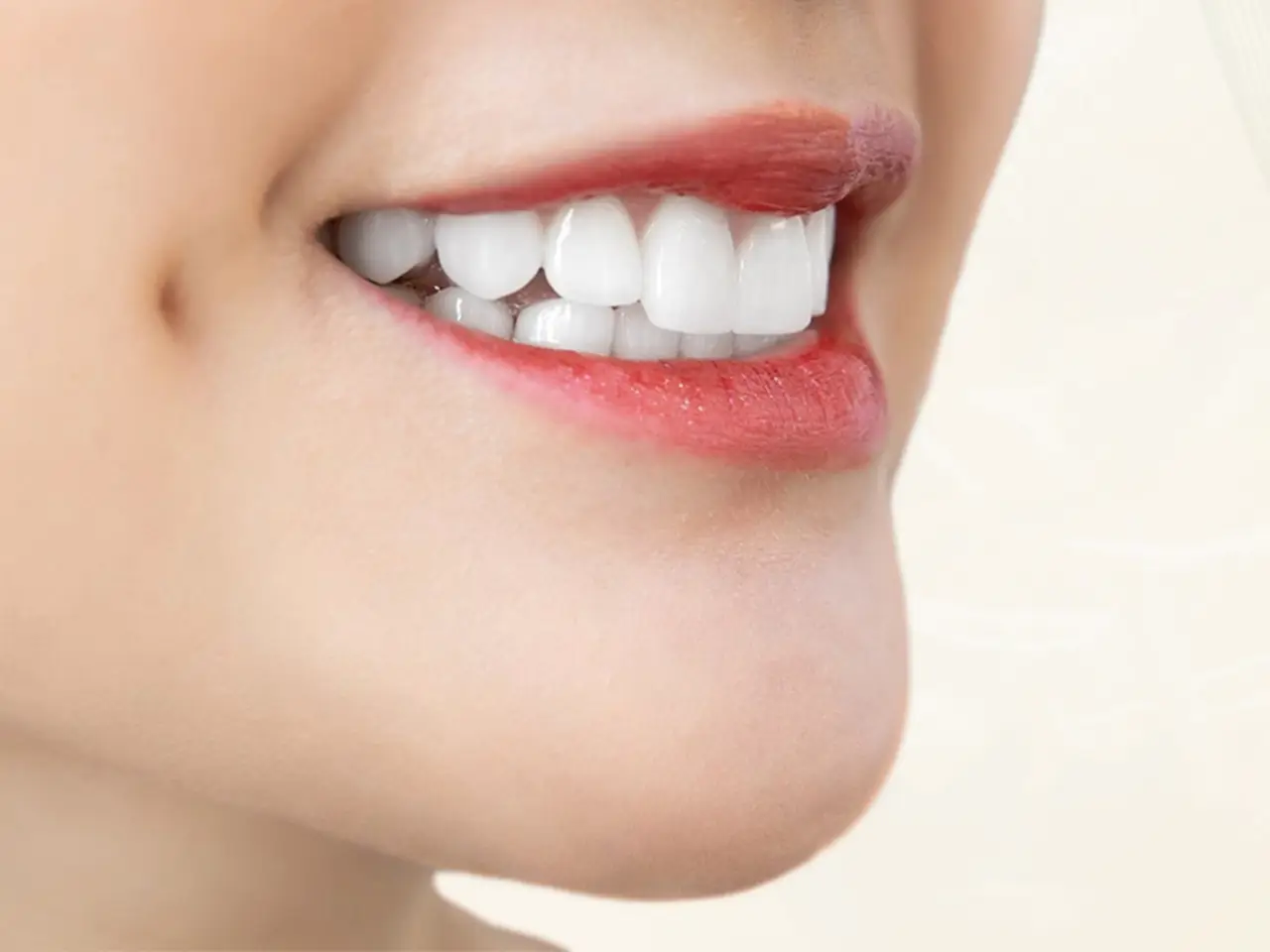 Bọc răng sứ ở đâu tốt TPHCM? Tiêu chí quan trọng cần biết