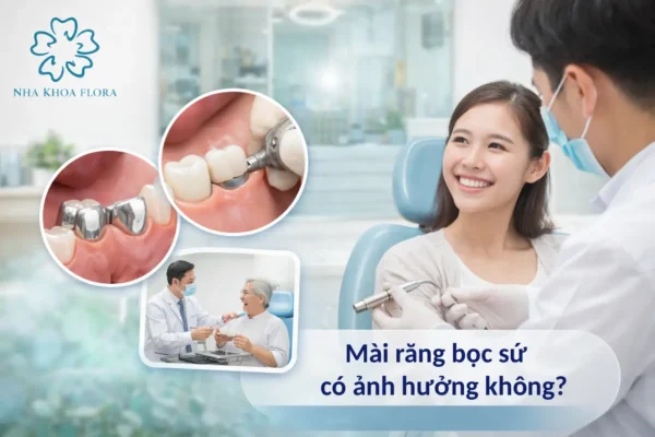 Mài răng bọc sứ có ảnh hưởng không? Phân biệt răng sứ kim loại và toàn sứ