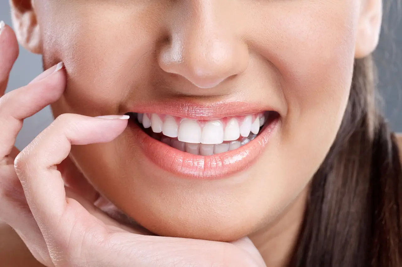 Veneer sứ TPHCM - Dán sứ veneer ở đâu đẹp TPHCM?