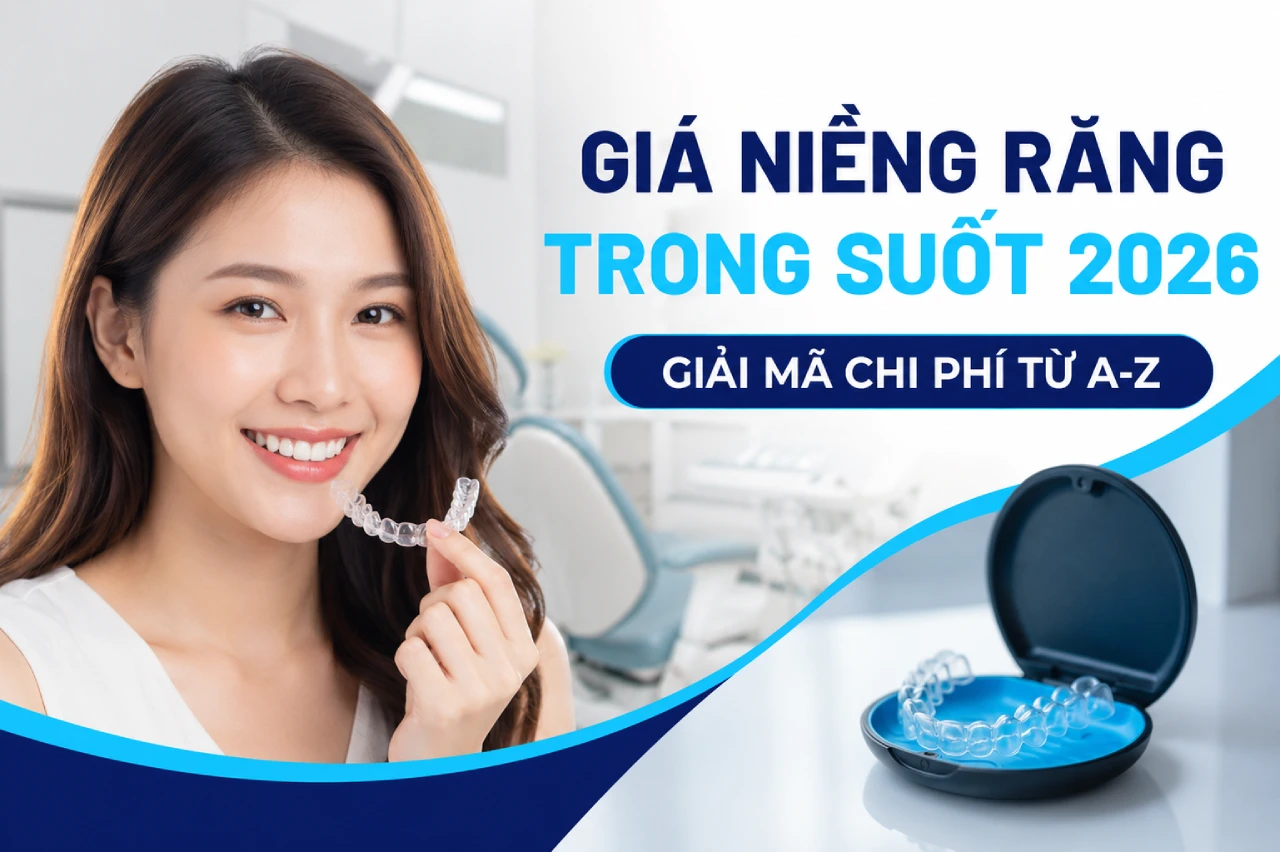 Giá niềng răng trong suốt 2026 - Giải mã chi phí từ A-Z dd