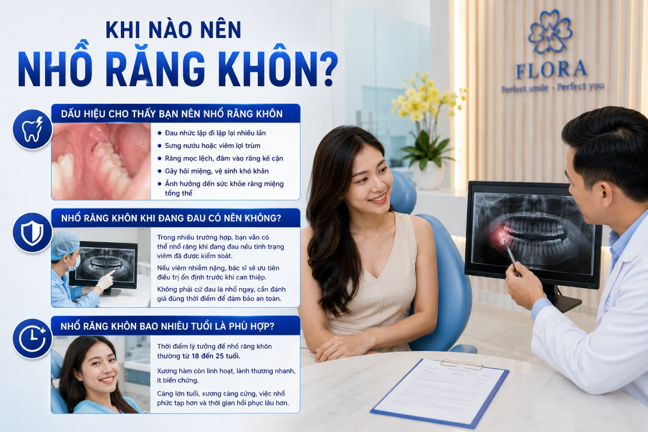 Khi nào nên nhổ răng khôn