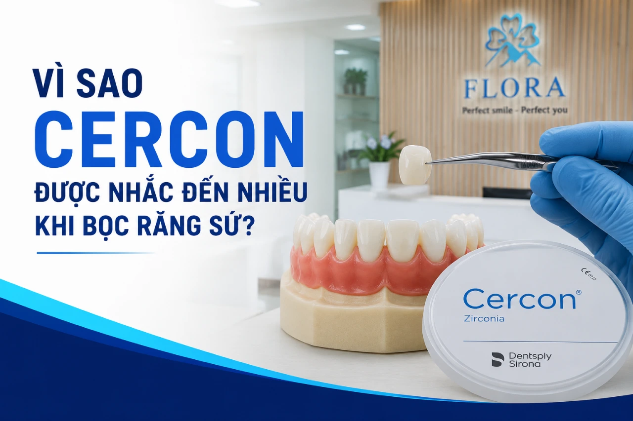 Vì sao “Cercon” được nhắc đến nhiều khi bọc răng sứ