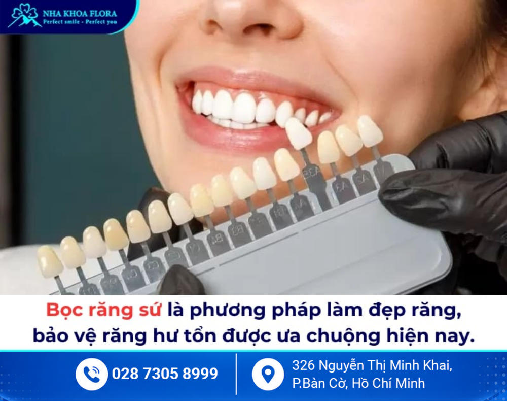 Bọc răng sứ thẩm mỹ 1