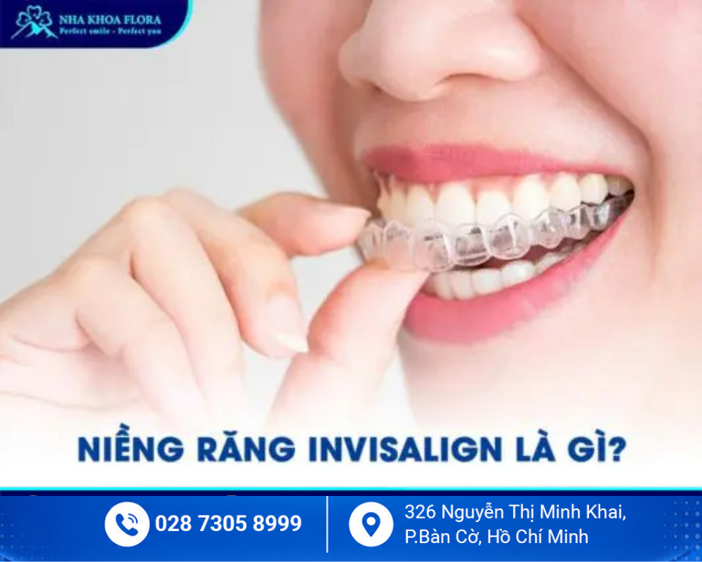 Niềng răng trong suốt Invisalign 1
